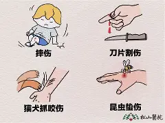 kaiyunapp-关于艠N?TuG囙傷_怙Q0S蝅轆璔B的信息